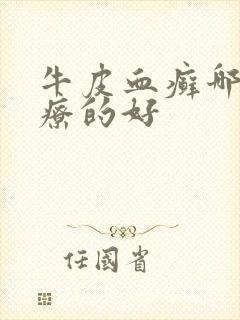 牛皮血癣哪里治疗的好