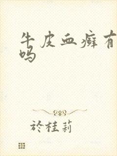 牛皮血癣有得治吗