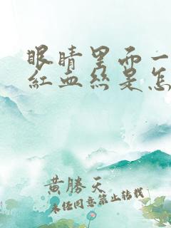 眼睛里面一直有红血丝是怎么回事