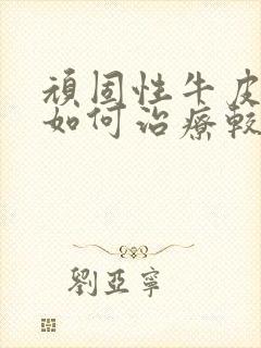 顽固性牛皮有癣如何治疗较好