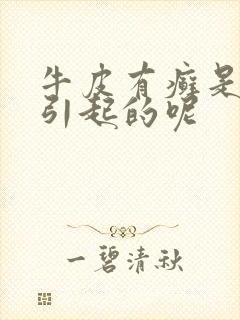 牛皮有癣是怎么引起的呢