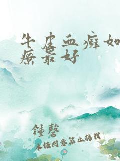 牛皮血癣如何治疗最好