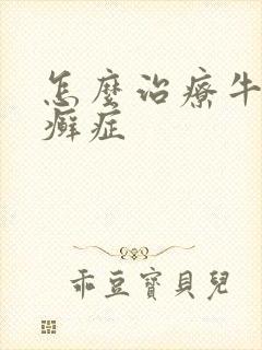 怎么治疗牛皮有癣症