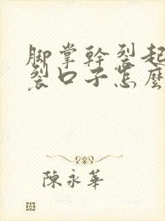 脚掌干裂起硬皮裂口子怎么办