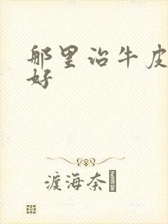 那里治牛皮比较好