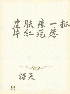 皮肤痒一抓就一片红疙瘩