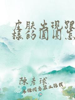 皮肤出现跟癣一样的圆圈怎么回事