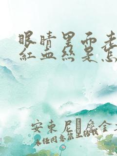 眼睛里面老是有红血丝是怎么回事