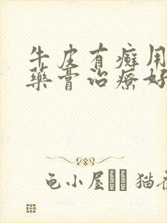 牛皮有癣用什么药膏治疗好的快些