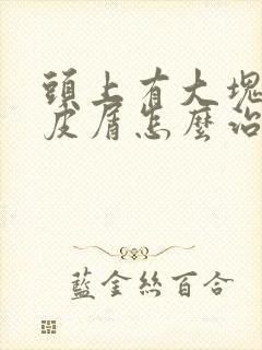 头上有大块的头皮屑怎么治疗