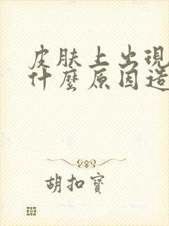 皮肤上出现癣是什么原因造成的