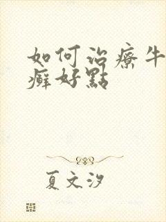 如何治疗牛皮有癣好点