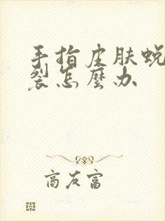 手指皮肤蜕皮开裂怎么办