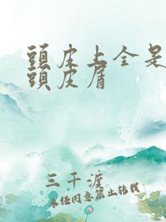 头皮上全是大块头皮屑