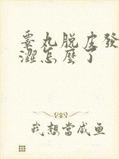 睾丸脱皮发痒干涩怎么了