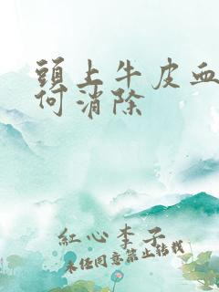 头上牛皮血癣如何消除