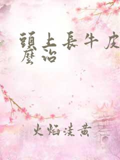 头上长牛皮选怎么治