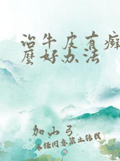 治牛皮有癣有什么好办法