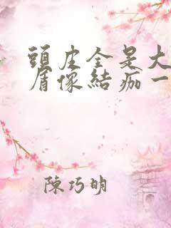 头皮全是大块头屑像结痂一样