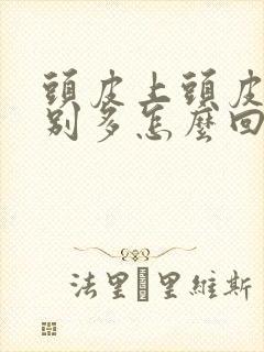 头皮上头皮屑特别多怎么回事