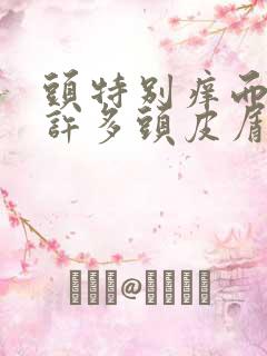 头特别痒而且有许多头皮屑怎么办