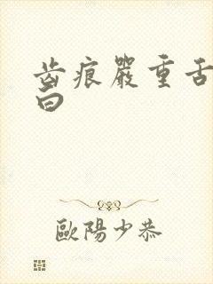 齿痕严重舌苔发白