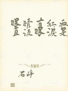 眼睛有红血丝一直流眼泪是怎么回事?