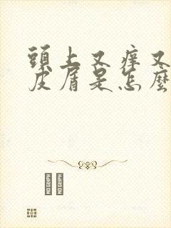 头上又痒又有头皮屑是怎么回事