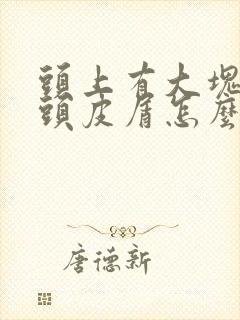 头上有大块白色头皮屑怎么回事