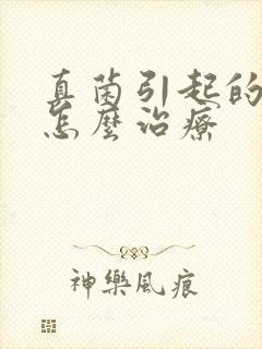 真菌引起的体癣怎么治疗