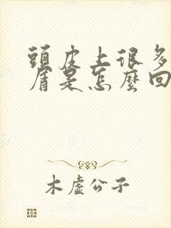 头皮上很多头皮屑是怎么回事