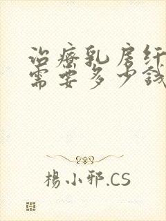 治疗乳房纤维瘤需要多少钱