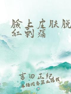 脸上皮肤脱皮发红刺痛