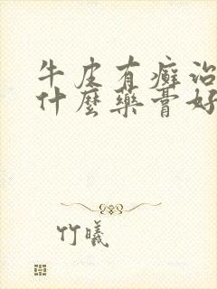 牛皮有癣治疗用什么药膏好