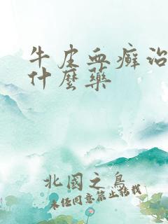 牛皮血癣治疗用什么药