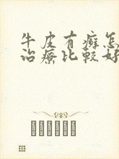 牛皮有癣怎么样治疗比较好