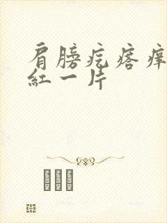 肩膀疙瘩痒抓了红一片