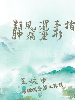 类风湿手指关节肿痛变形