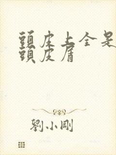 头皮上全是大块头皮屑