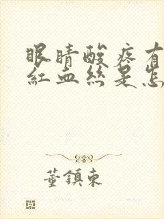 眼睛酸疼有大量红血丝是怎么回事