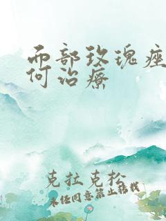 面部玫瑰痤疮如何治疗