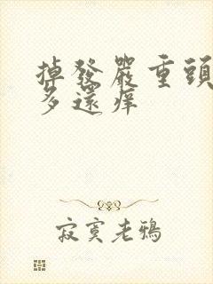 掉发严重头皮屑多还痒