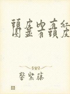 头皮内有红色圆圈并有头皮屑