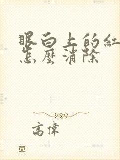 眼白上的红血丝怎么消除