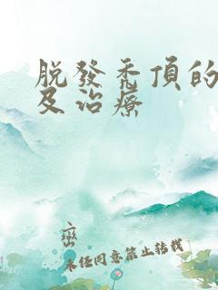 脱发秃顶的原因及治疗