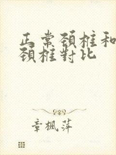 正常颈椎和反弓颈椎对比