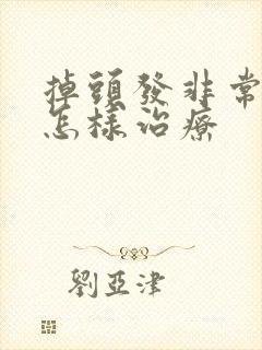 掉头发非常严重怎样治疗