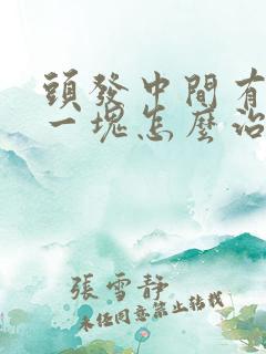 头发中间有秃了一块怎么治疗