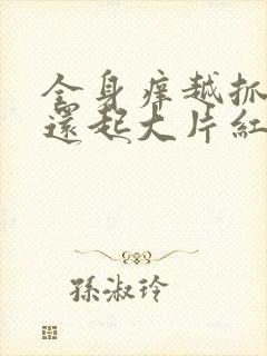 全身痒越抓越痒还起大片红疙瘩