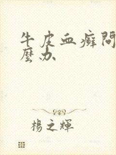 牛皮血癣问题怎么办